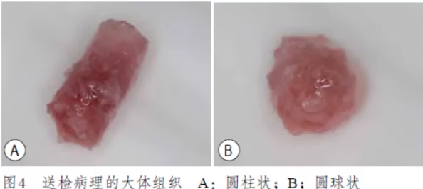 屄视频关于女性生殖器的影像资料及相关讨论